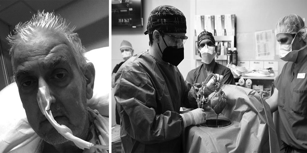 सुँगुरको मुटु प्रत्यारोपण गरिएका डेबिटको मृत्यु